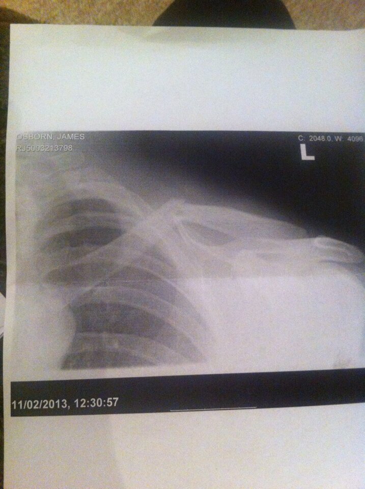 Coping with Injury